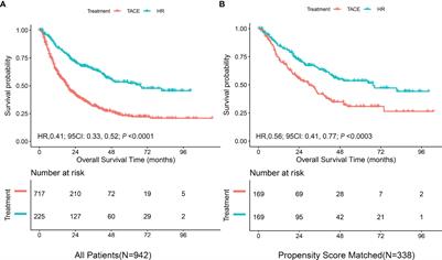 Hepatic Resection Versus Transarterial Chemoembolization for Intermediate-Stage Hepatocellular Carcinoma: A Cohort Study